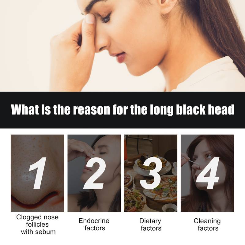 Deep Cleansing Blackhead Remover Strips (Pack of 20)